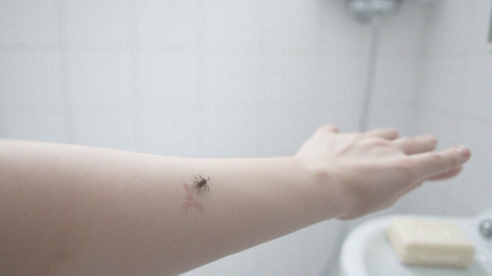 Jakie są konsekwencje bagatelizowania swędzenia?