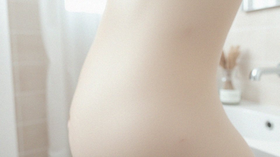 Jakie są przyczyny powstawania rozstępów?